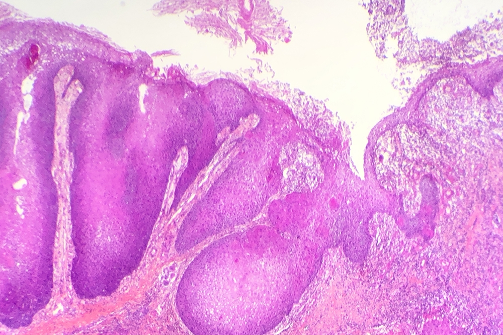 technopole-pathologie-image-anapath-1-1