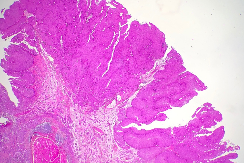 technopole-pathologie-image-anapath-2-1