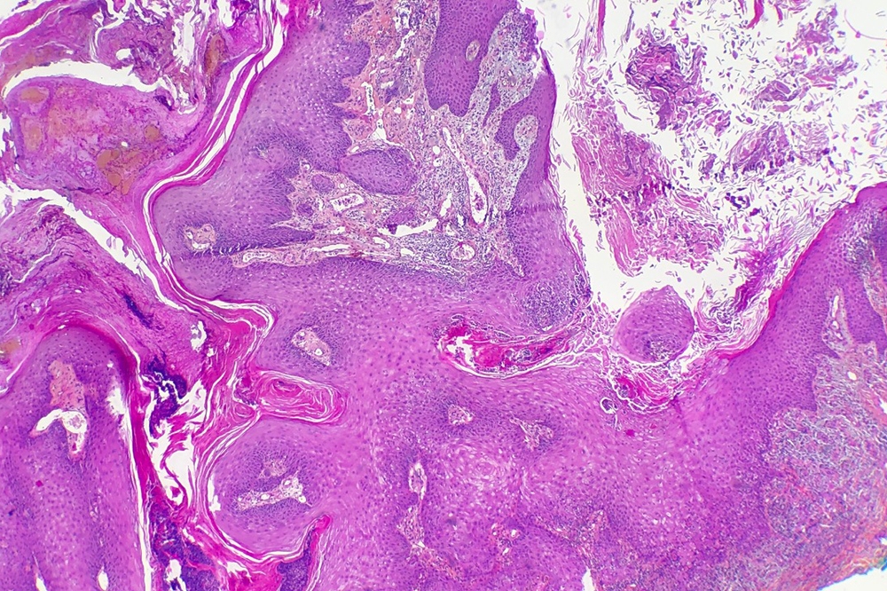 technopole-pathologie-image-anapath-3-1